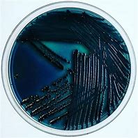 Image result for Vibrio Parahaemolyticus Gram Stain