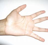 Image result for hand transplant