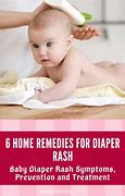 Image result for Food Allergy Rash Toddler