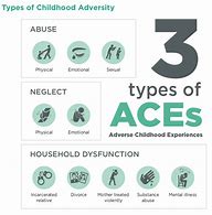 Image result for ace�s