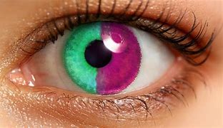 Image result for Rare Pink Eye Color
