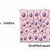 Image result for Gonorrhea Pathogenesis