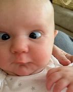 Image result for Baby with Cross Eyes