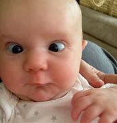 Image result for Cross Eyed Babies
