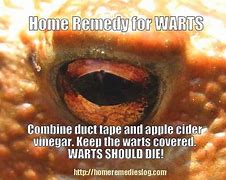 Image result for Common Wart On Finger Removal