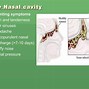 Image result for Upper Respiratory Tract Infection PPT