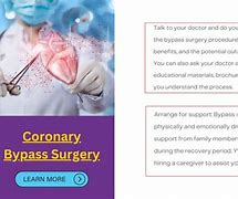 Image result for Cardiac Bypass Cannulation