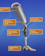 Image result for Prosthetic Leg Components