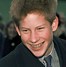 Image result for Prince Harry Braces
