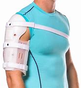 Image result for Humeral Fracture Splint