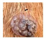Image result for Wart Like Bumps On Skin