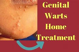 Image result for Genital Warts Removal Kit