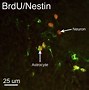 Image result for Basic Nerve Cell