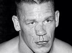 Image result for John Cena Nose Injury