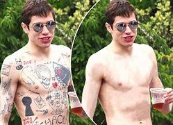 Image result for Pete Davidson Tattoo Removal Before and After