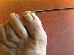 Image result for Curved Foot