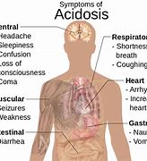 Image result for acidosia