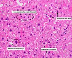 Image result for Normal Liver Pathology