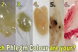 Image result for Phlegm Color Infection