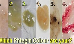 Image result for Phlegm Color Chart for Adults