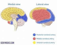 Image result for Brain Anatomy and Stroke
