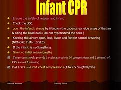 Image result for Recover Guidelines CPR