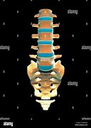 Image result for Lumbar Spine and Sacrum