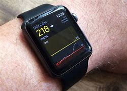 Image result for Glucose Monitoring Watches
