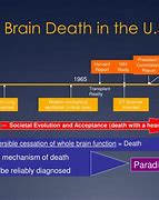 Image result for Dead of the Brain Deaths