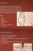 Image result for inflamatorio