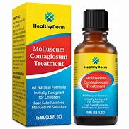 Image result for Treatment Options for Molluscum Contagiosum