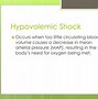 Image result for Initial Stage of Shock