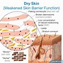 Image result for Different Types of Dry Skin