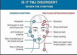 Image result for Upper Jaw Pain