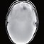 Image result for Alobar Holoprosencephaly MRI