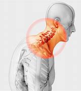 Image result for Neck Pain