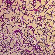 Image result for Bacillus Megaterium Gram Stain
