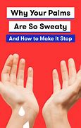 Image result for Sweat Rash Treatment