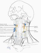 Image result for Location of Carotid Artery Bulb in Neck