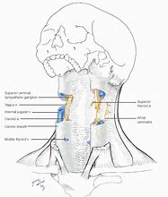 Image result for Carotid and Vertebral Arteries