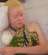 Image result for Smallest Albino Bat