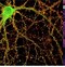 Image result for Big Brain Galaxy