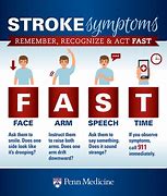 Image result for Mini Stroke Signs and Symptoms