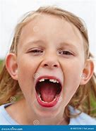 Image result for Child Open Mouth Side View