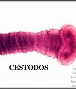 Image result for cestodo