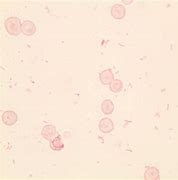 Image result for White Blood Cells Gram Stain