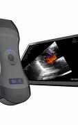 Image result for Handheld Ultrasound Machine