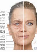 Image result for Anatomy of the Aging Face