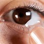 Image result for Orthokeratology Contact Lenses