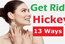Image result for How to Get Rid of a Hickey Fast Cocoa Butter